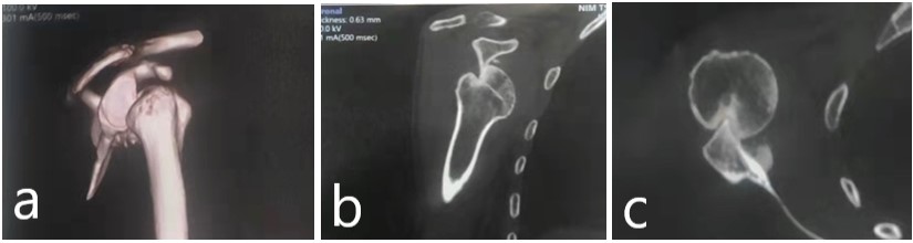 figure 3 ct images of patient 3d model showing anterior