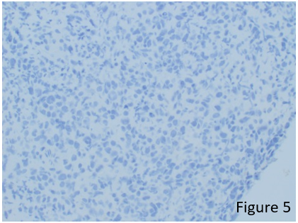 figure 5 alk negative stain