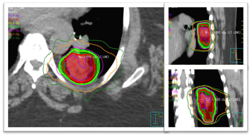 figure 2 tumor location